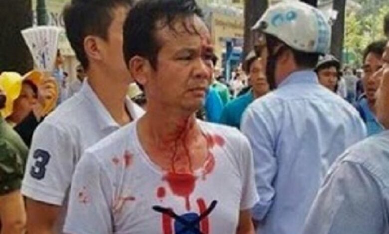 Chiến cuộc biên giới Việt-Trung, và những người bị đối xử tệ bạc Chiến cuộc biên giới Việt-Trung, và những người bị đối xử tệ bạc