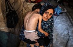 Phóng viên BBC ám ảnh với hình ảnh trẻ em Palestine bị suy dinh dưỡng vì đạn pháo của Israel Phóng viên BBC ám ảnh với hình ảnh trẻ em Palestine bị suy dinh dưỡng vì đạn pháo của Israel