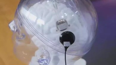 Trung Quốc hoàn thành ca cấy chip não – máy tính thương mại đầu tiên