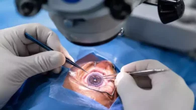 Việt Nam đưa công nghệ ghép giác mạc sinh học vào ứng dụng