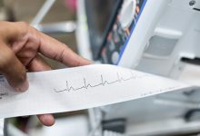 EKG là gì? Khám phá công dụng và ý nghĩa của xét nghiệm tim phổ biến này